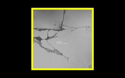 Recensioni Radioaktiv Anèdone – La Superficie Delle Cose