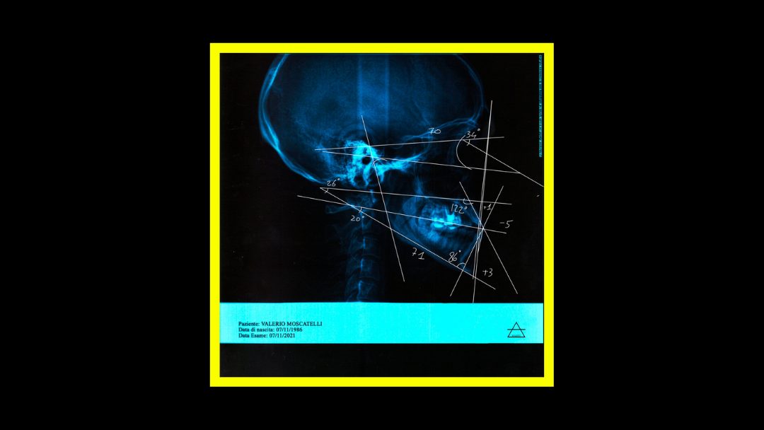 Valerio Moscatelli – Stress Test